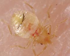 Bed Bugs Pictures: Actual Size, Stages and Skin Bites
