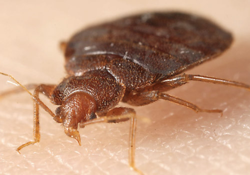 Bed Bug Bites: Pictures, Patterns, Symptoms and Remedy