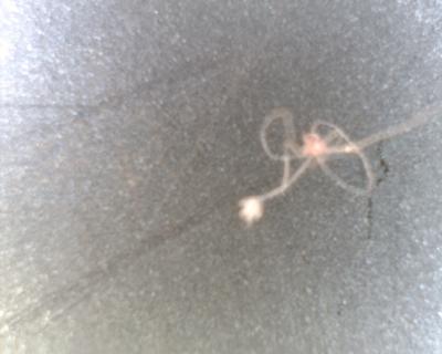 Fibers Consistent with Morgellons