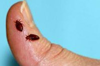 Beg bugs on human thumb - magnified view