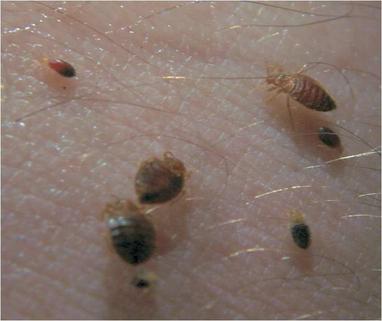 Baby Bed Bugs Pictures Size And How To Identify Bites