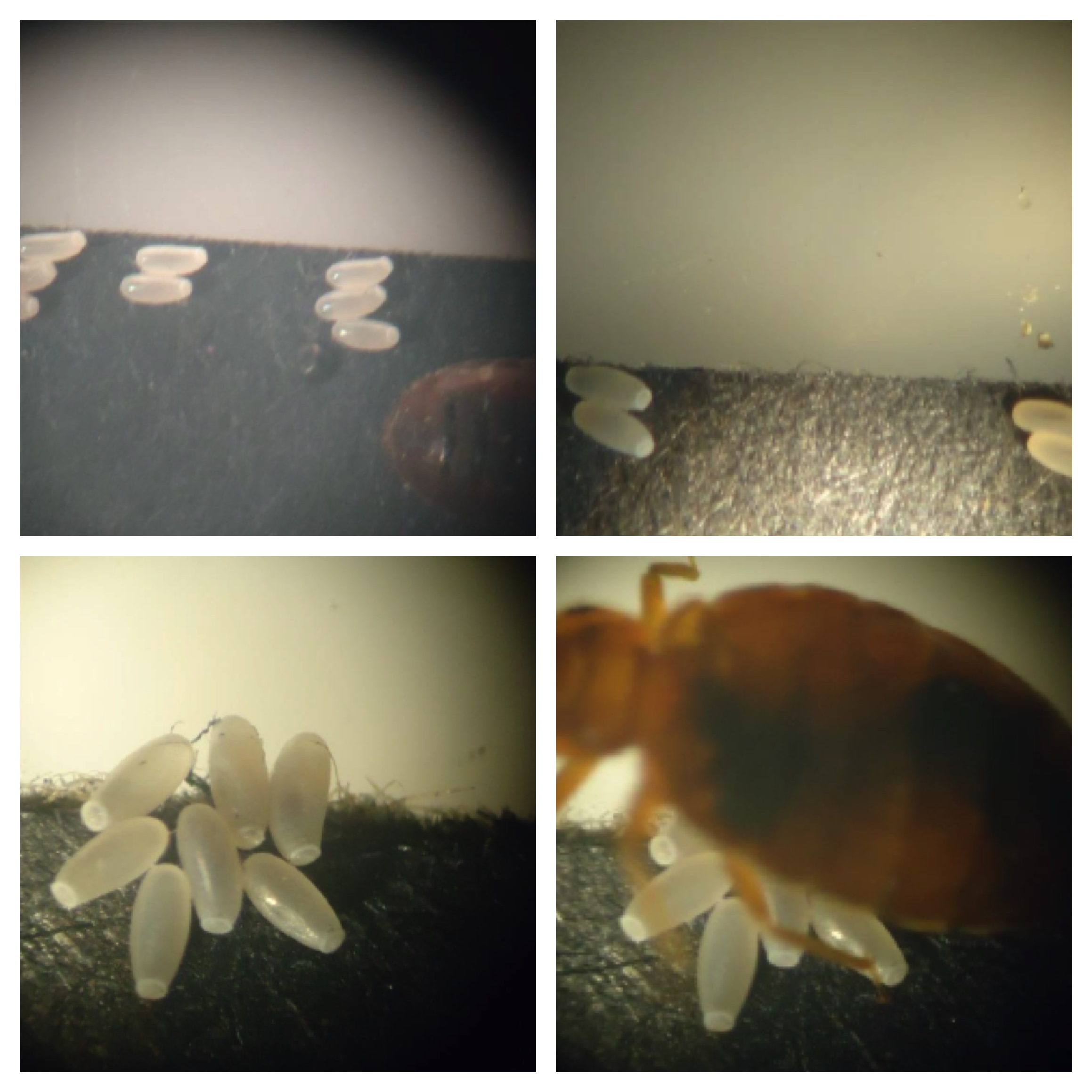 4 pictures of magnified bed bug eggs