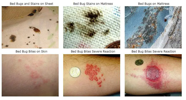Pictures showing bed bug mattress stains and bite symptoms