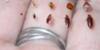 Picture Bed Bug Lifecycle Before and After Feeding